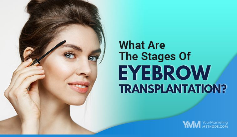 What Are The Stages Of Eyebrow Transplantation Featured Image YMM