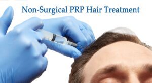 prp hair treatment- Non-surgical prp hair transplant