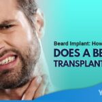 Beard Implant How Much Does a Beard Transplant Cost Featured Image YMM