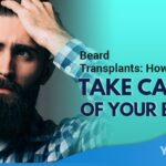 Beard Transplants How to Take Care of Your Beard Featured Image YMM