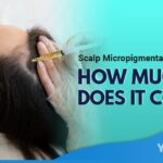 Scalp Micropigmentation Cost