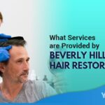 What Services are Provided by Beverly Hills Hair Restoration Featured Image YMM