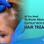 All You Need To Know About Platelet Rich Plasma Hair Treatment Featured Image YMM