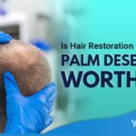 Is Hair Restoration in Palm Desert Worth it Featured Image YMM
