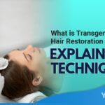 What is Transgender Hair Restoration and Explain its Techniques Featured Image YMM