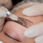 Eyebrows Restoration Surgery