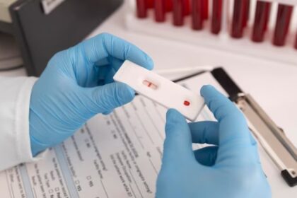 A Pap Test